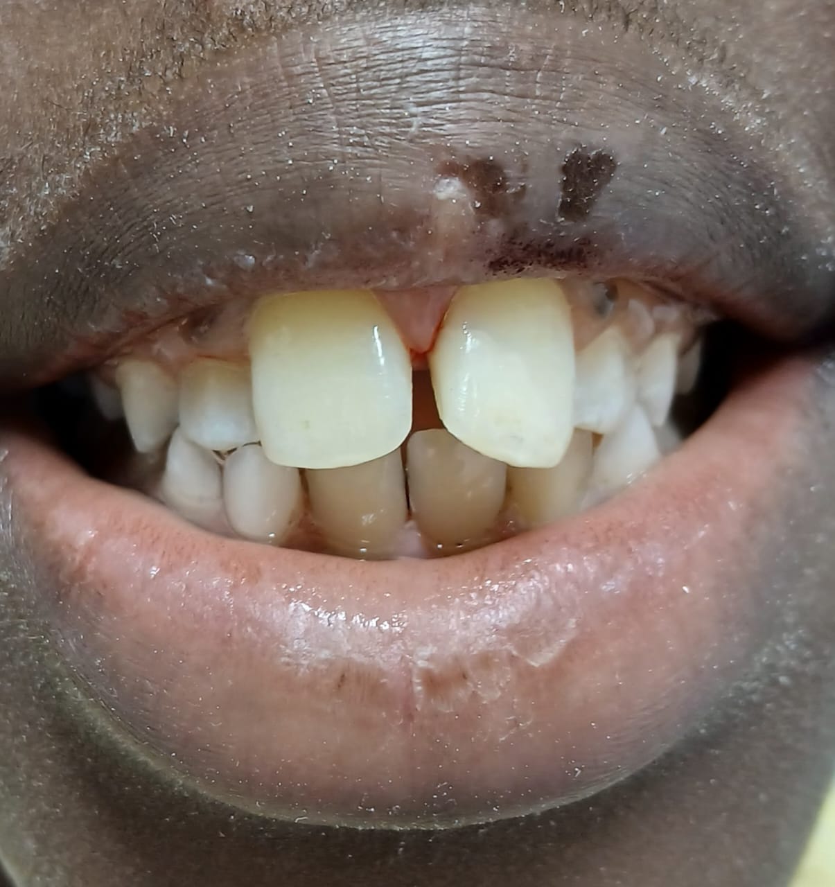 Antes do tratamento — Caso 3