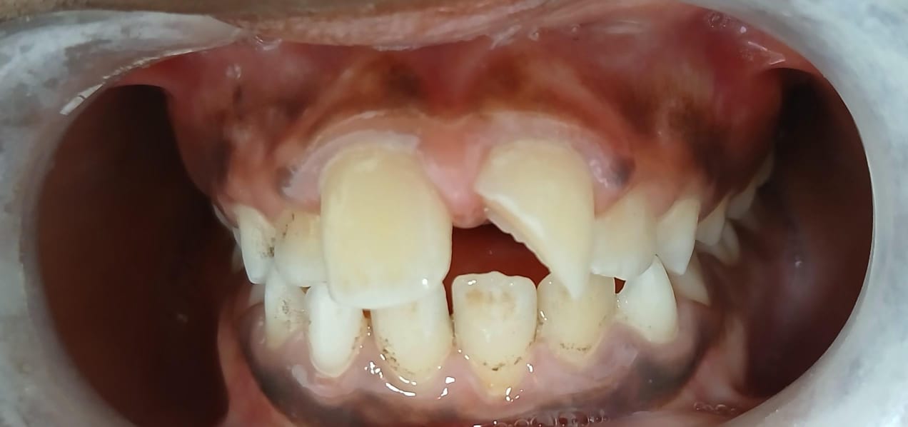 Depois do tratamento — Caso 3