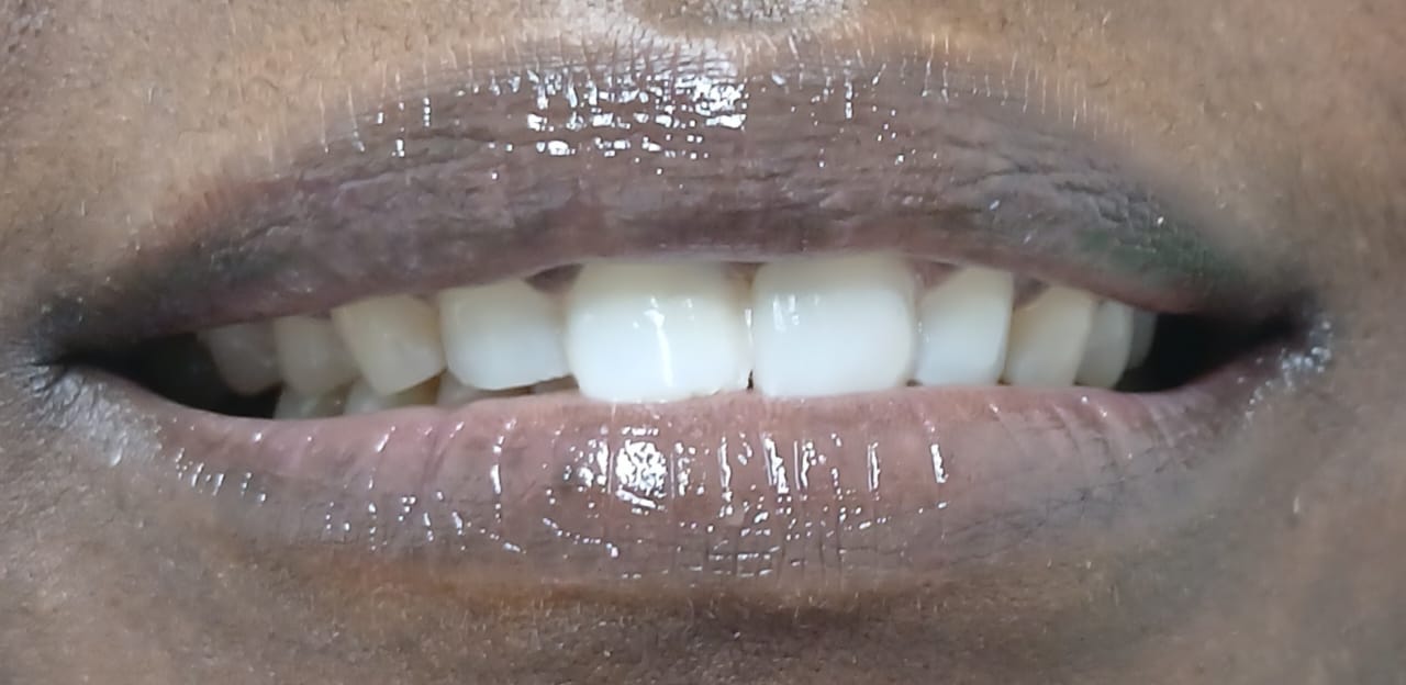 Antes do tratamento — Caso 1